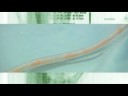 validación tecnica extración celulas madre desde la grasa de una liposuccion
