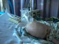 videos de First Look at Cameron's New Head
