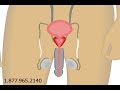 Prostate Miracle by Prostate-Miracle.com Prostate Miracle by Prostate-Miracle.com