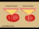 Prostate Miracle by Prostate-Miracle.com