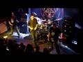 feto in fetus live - gdynia 12-10-2008