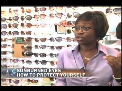 how to relieve sunburned eyes