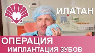 Имплантация зубов. Москва