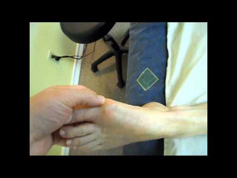 how to relieve bunion pain