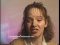 Tendonitis :: Mangosteen juice experience Tendonitis :: Mangosteen juice experience