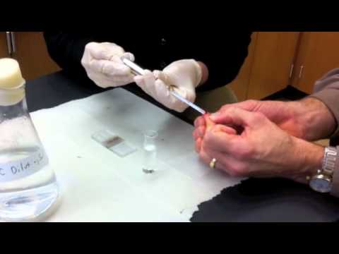 how to perform rbc count