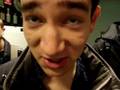 videos de J1J a strasbourg