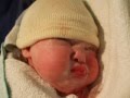 Maisie Jane 0-6 months Spina Bifida Hydrocephalus