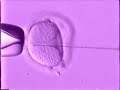 FIV - Fertilização in vitro FIV - Fertilização in vitro