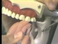 Curet Scalers