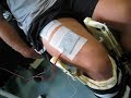 Muscle Electrical Stimulation Muscle Electrical Stimulation