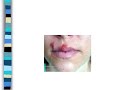 Herpes Virus-SBroderick5