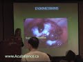 Endometriosis & Infertility