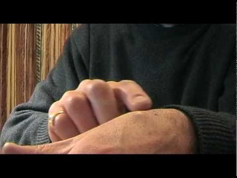 how to drain ganglion cyst