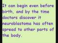 Neuroblastoma.