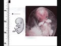 Pro-life video