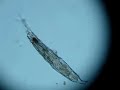 rotifer Rotaria trisecata found in pond vegetation, Poland