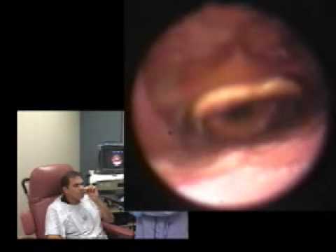 how to perform endoscopy