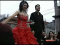medi pare pare