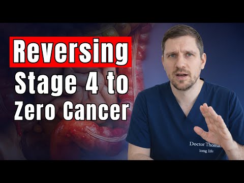This Is Feeding Cancer Cells! How To Cut Off Cancer's Favorite Fuel