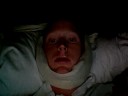 Upper and Lower jaw surgery pt7 Sleeplessness Upper and Lower jaw surgery pt7 Sleeplessness