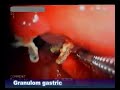 Chirurgie Onesti
