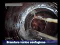 Chirurgie Onesti