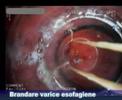 Chirurgie Onesti