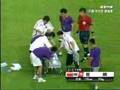 タンカから選手落下ｗｗｗｗｗ