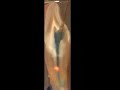 Dr Justin Kolnick on FOX NEWS - Laser Endodontics