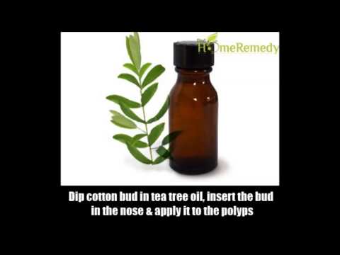 how to cure nasal polyps