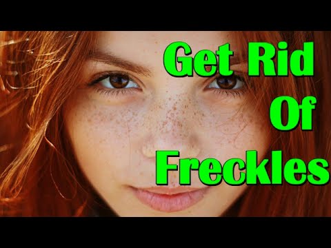 video-linktoworks-How To Get Rid Of Freckles Naturally and Fast