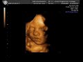 este es nuestro bebe