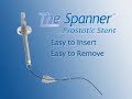 Urethral-Catheter-an