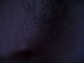 asthma attack with Pectus excavatum (dangerous) 5