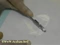 zno& eugenol cement