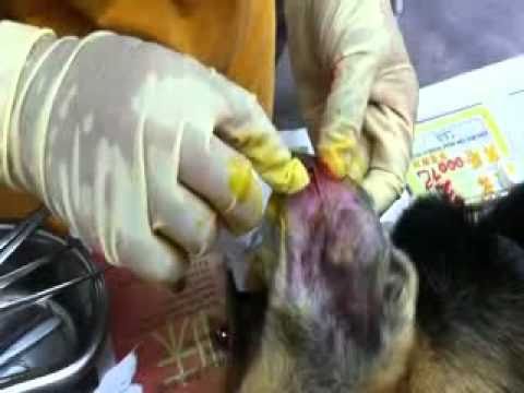 how to treat hematoma after c section