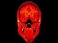 my fMRI