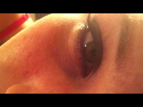 how to control pupil dilation