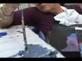 Brain Injury and Fine Arts