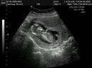 Baby Cooksey 3 Baby Cooksey 3