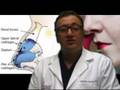 Revision Rhinoplasty