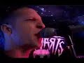Restarts - Timewaster