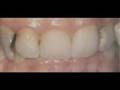 General Dental Problems Help default General Dental Problems Help