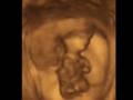 videos de Think of him when you vote . . .