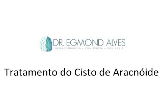 Egmond Alves-21