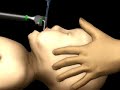 Paediatric Endotracheal Intubation