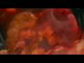 videos de Abba  Soldiers  (Cold December Vision Mix)  Widescreen  (1981)