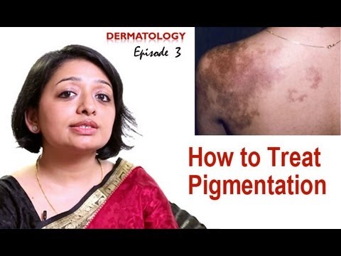how to cure hyperpigmentation
