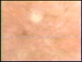 Clearasil